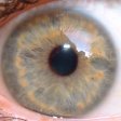 Iridology